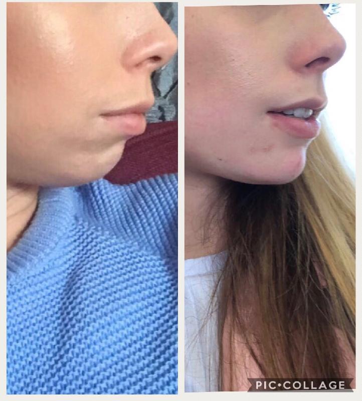 Amazing results by Dr Joshua