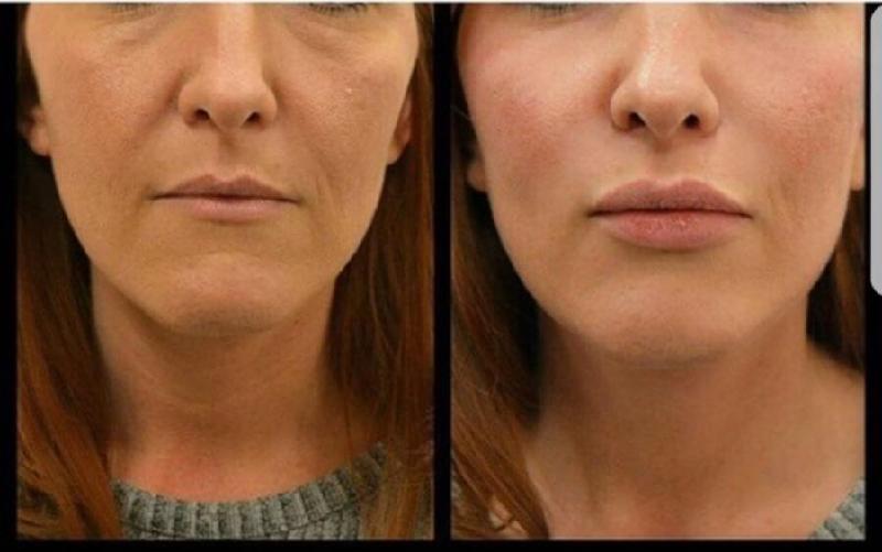 The AMAZING Consultant Clinic
