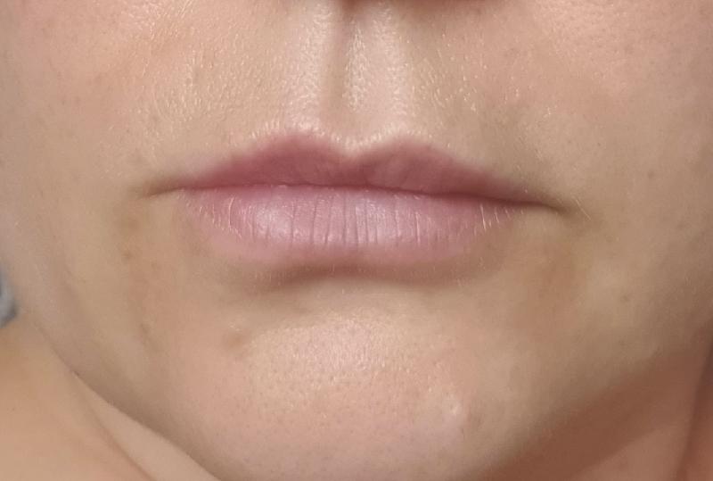 Lip plumper worked wonders but bit to hot