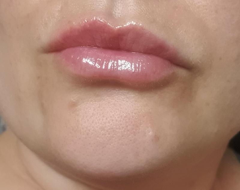 Lip plumper worked wonders but bit to hot
