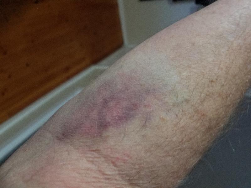 Venue was difficult to find and the poor nurse made the sample point look l