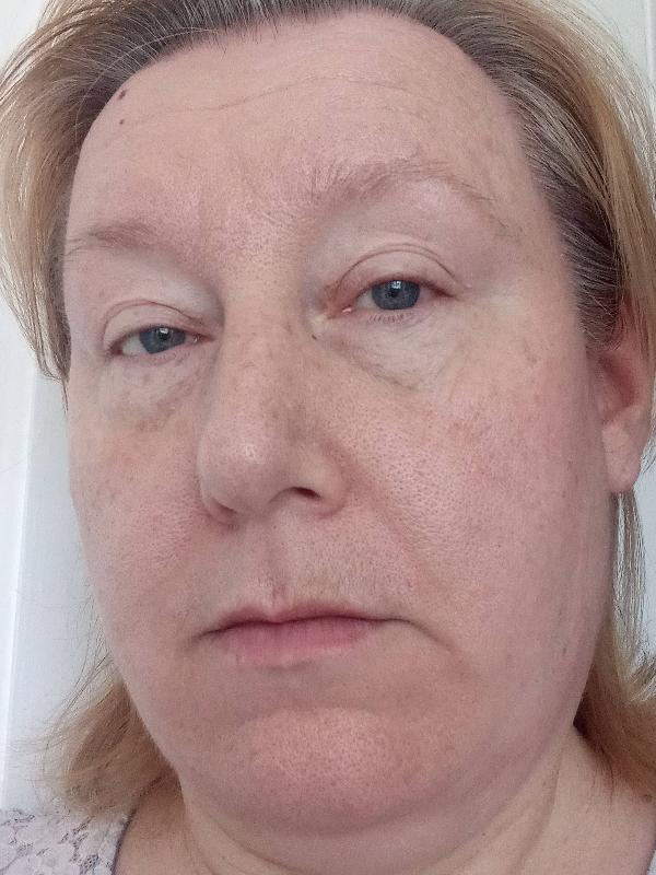 Excellent service from SkinChemist's