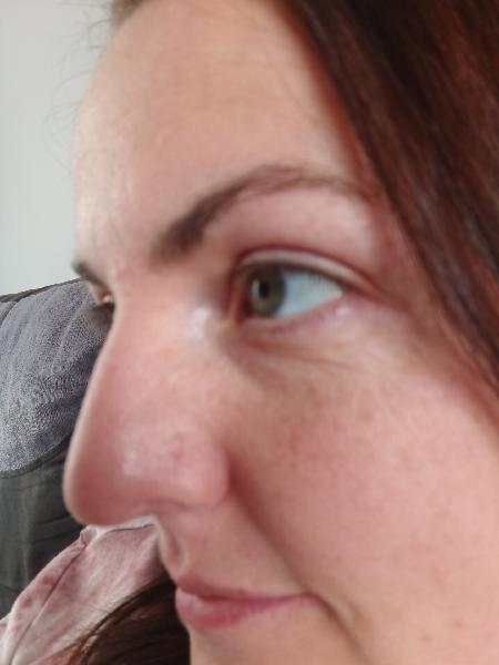 Excellent skin clinic. I had mole removal with fantastic results