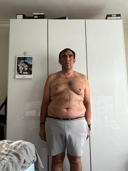 Weight Loss Medication