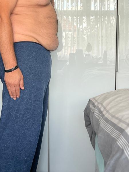 Weight Loss Medication