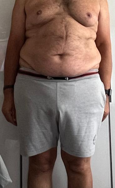 Weight Loss Medication