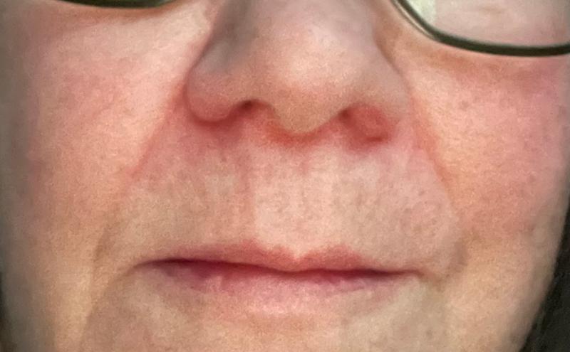 Tender Skin Balm