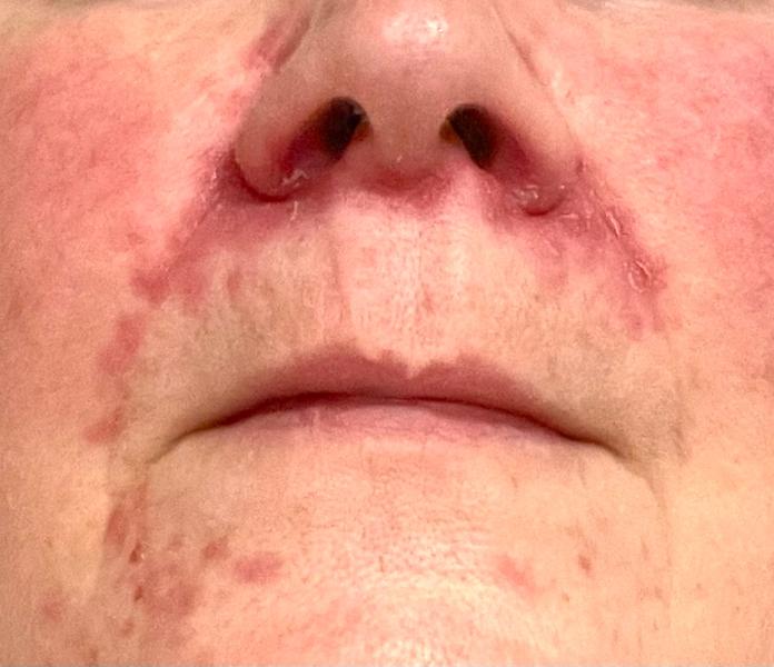 Tender Skin Balm