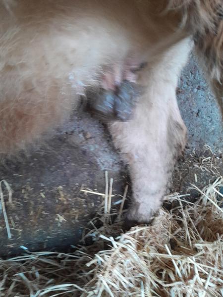 wart removed
