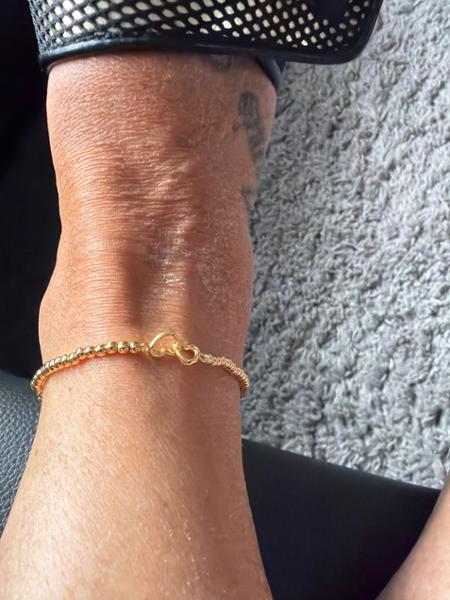 Jim’s ankle bracelet